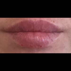 After Image: Lips