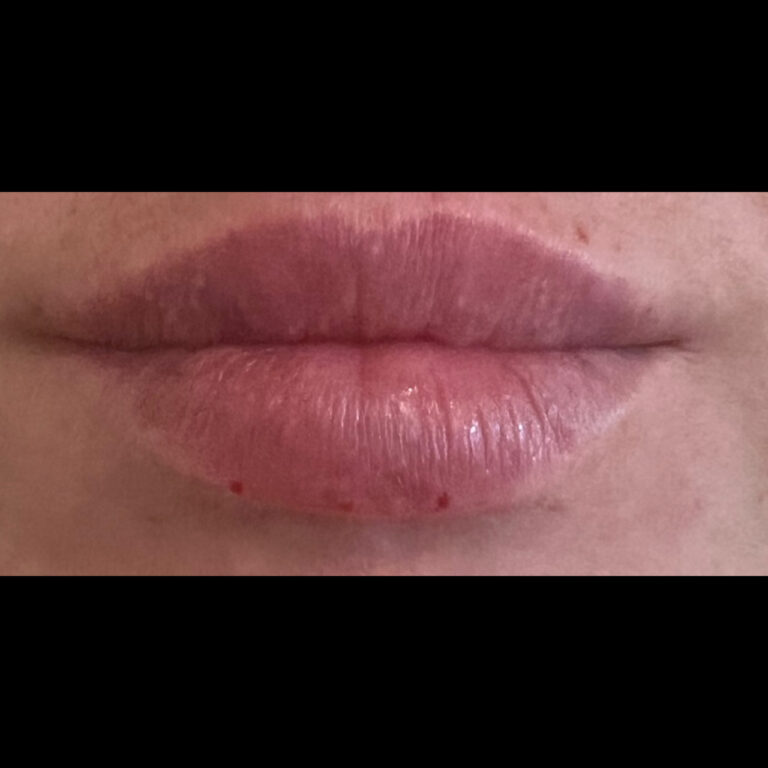 After Image: Lips - front