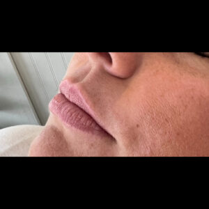 Before Image: Lips