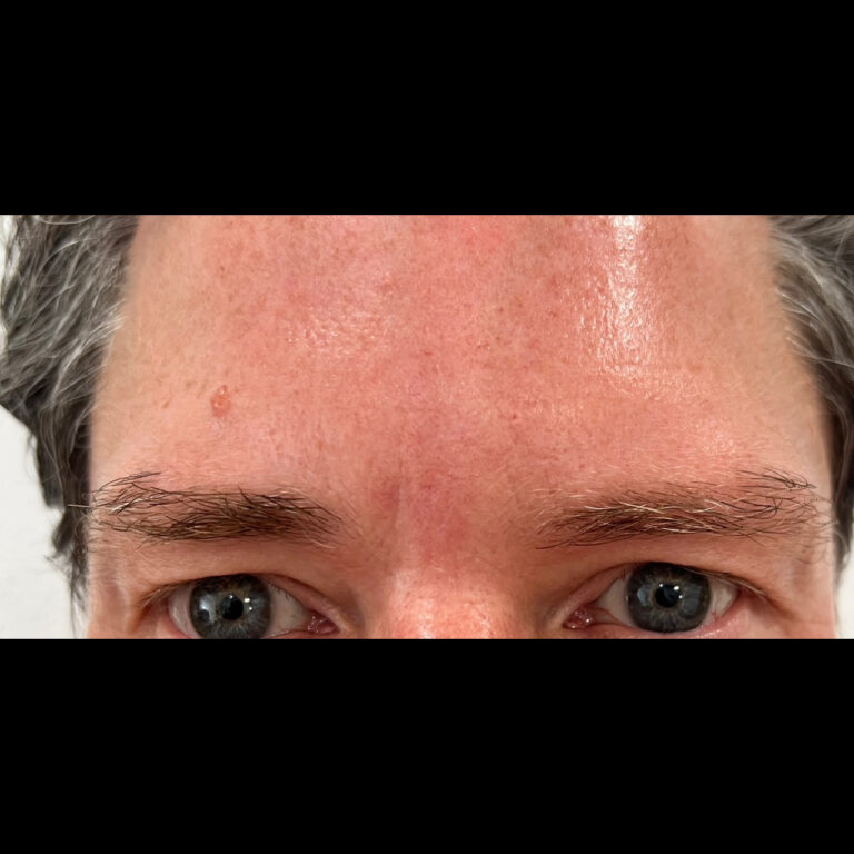 After Image: Neurotoxins - front